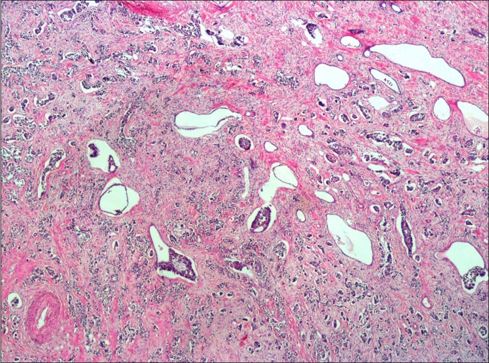 Journal of Clinical Case reports and Images-Acute