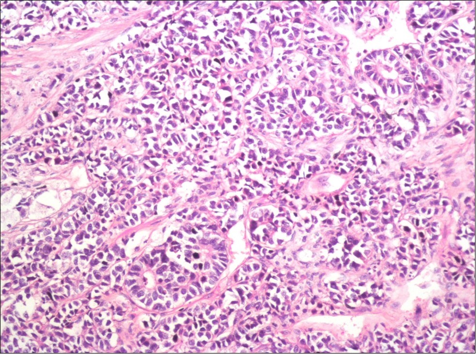Journal of Clinical Case reports and Images-Acute