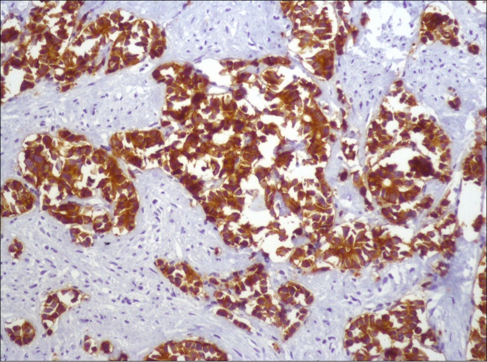 Journal of Clinical Case reports and Images-Acute