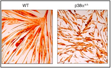 skeletal muscle