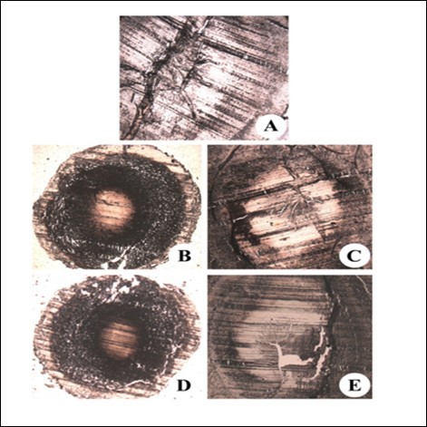 Journal of Ophthalmic Science-Cataract