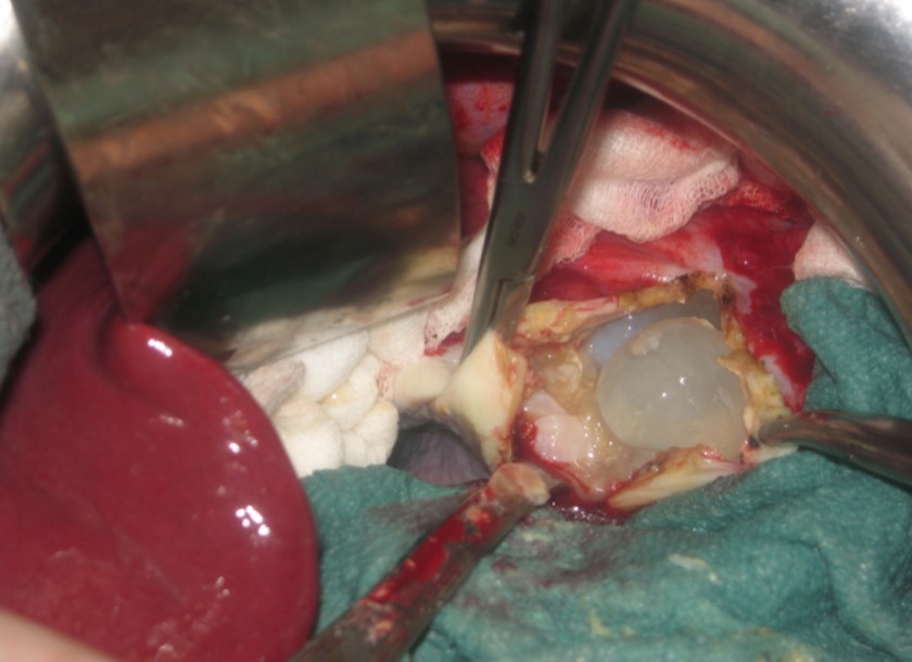 Journal of Spleen And Liver Research-spleen-preserving surgery