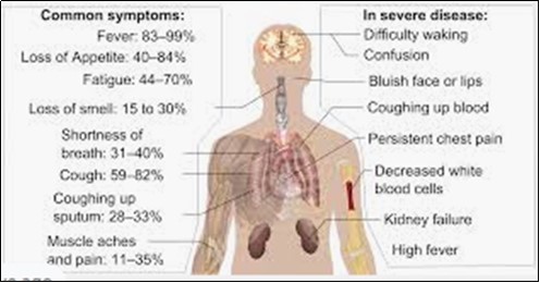 International Journal of Coronaviruses-COVID-19