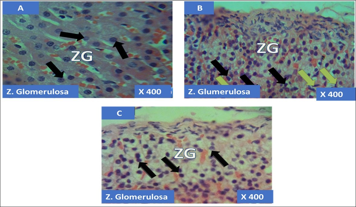 International Journal of Human Anatomy-Adrenal gland