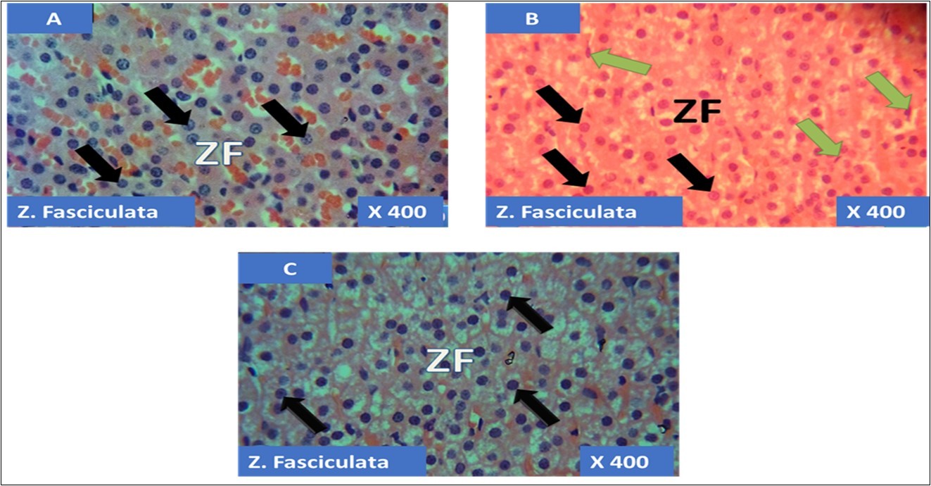 International Journal of Human Anatomy-Adrenal gland
