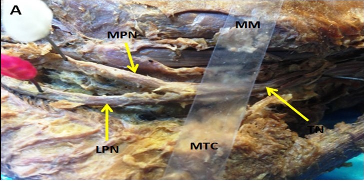 International Journal of Human Anatomy-Anatomy
