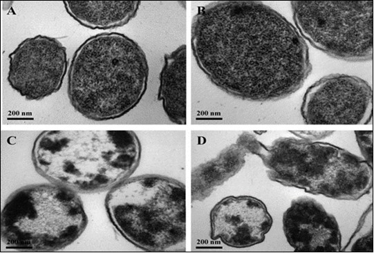 International Journal of Infection Prevention-Healthcare Associated Infections