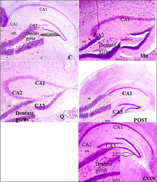 International Journal of Human Anatomy-Neurotoxicity