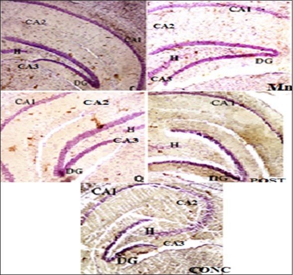 International Journal of Human Anatomy-Neurotoxicity