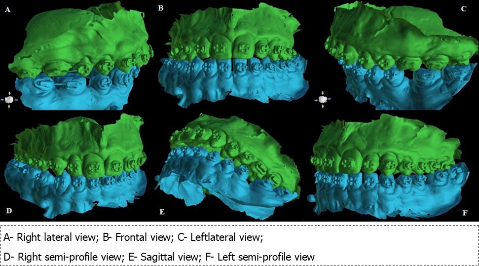 Journal of Dentistry And Oral Implants-mini-implant