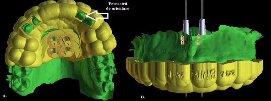 Journal of Dentistry And Oral Implants-mini-implant