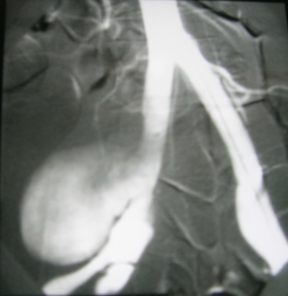 Journal Of Hypertension And Cardiology-hypertension