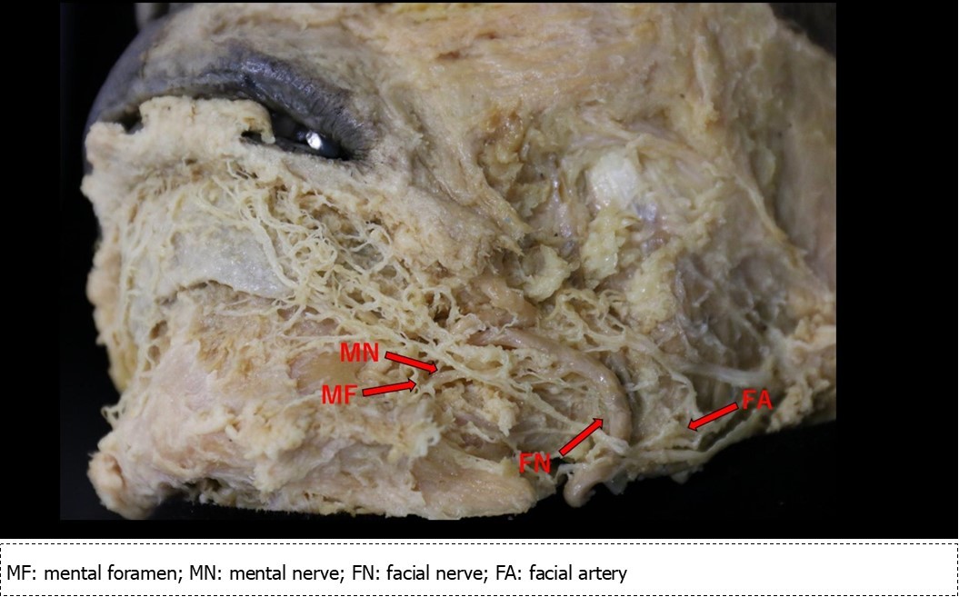 International Journal of Human Anatomy-mental nerve