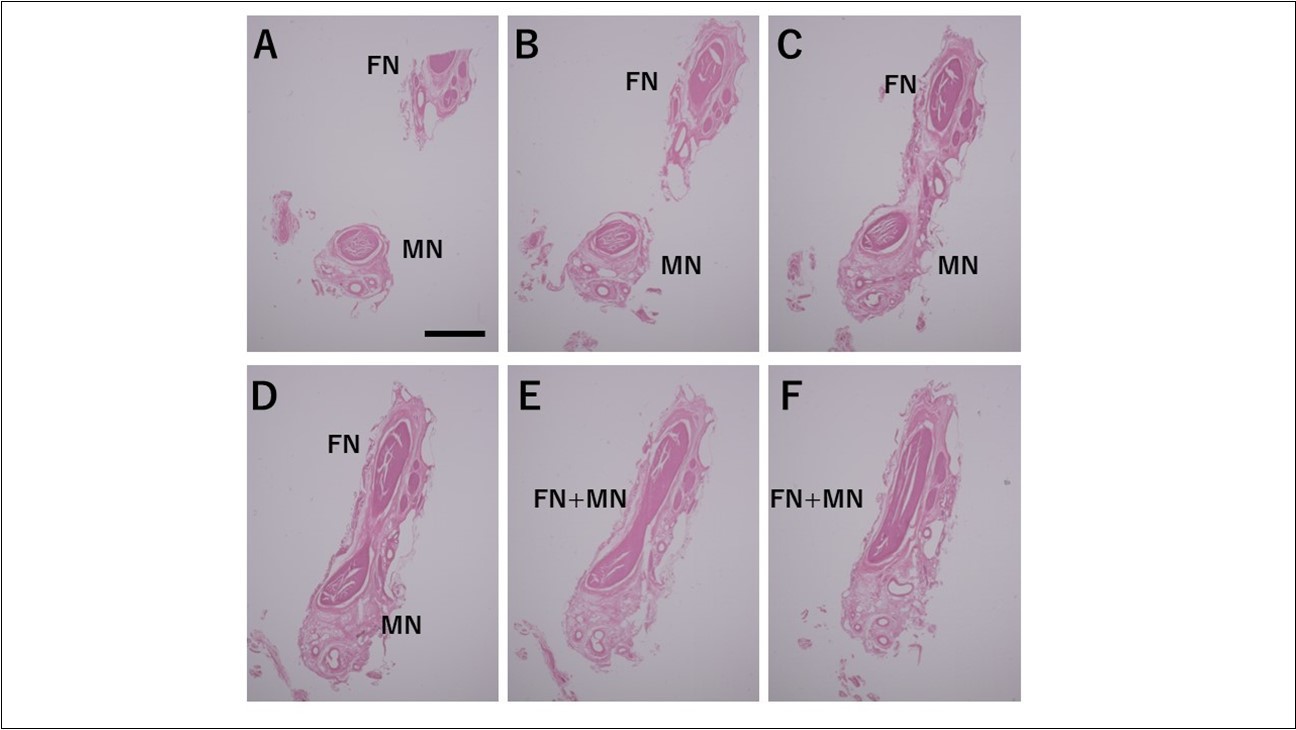 International Journal of Human Anatomy-mental nerve