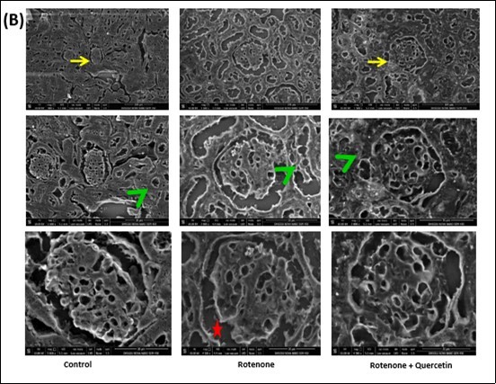 International Journal of Human Anatomy-Rotenone