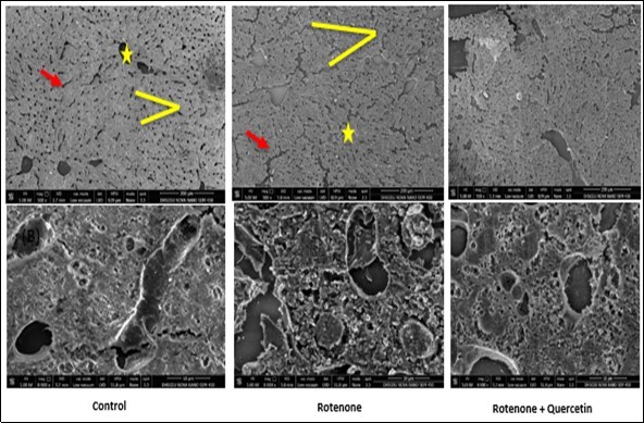 International Journal of Human Anatomy-Rotenone