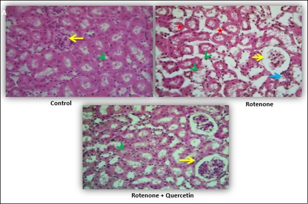 International Journal of Human Anatomy-Rotenone