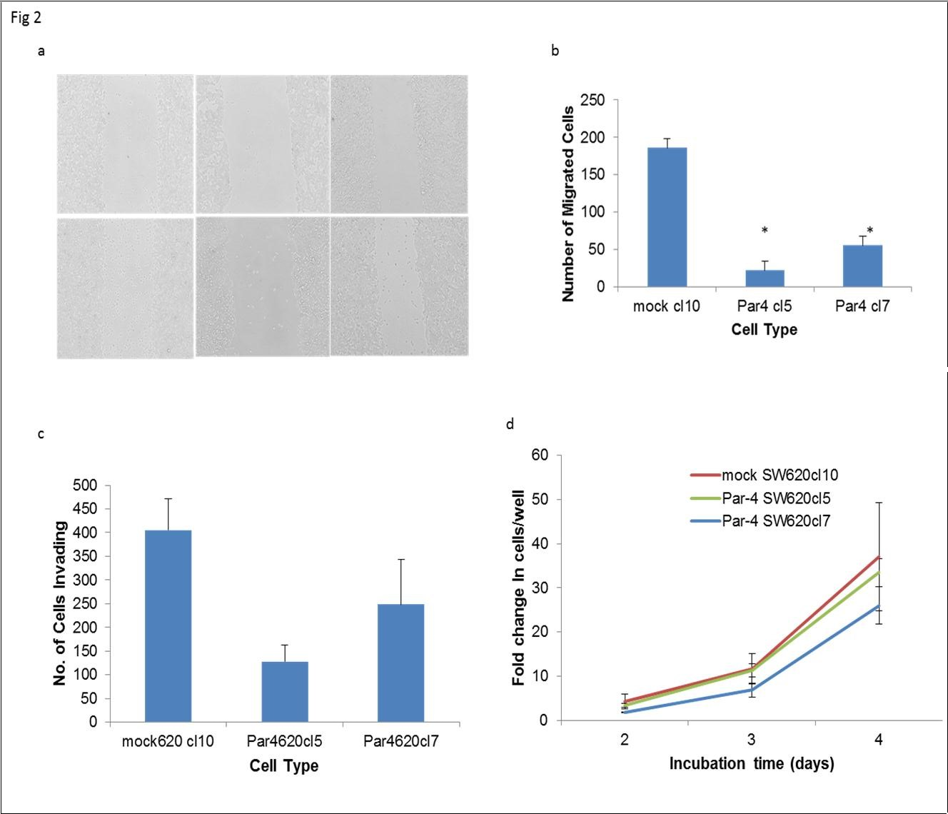 Journal Of Colon And Rectal Cancer-Colon cancer