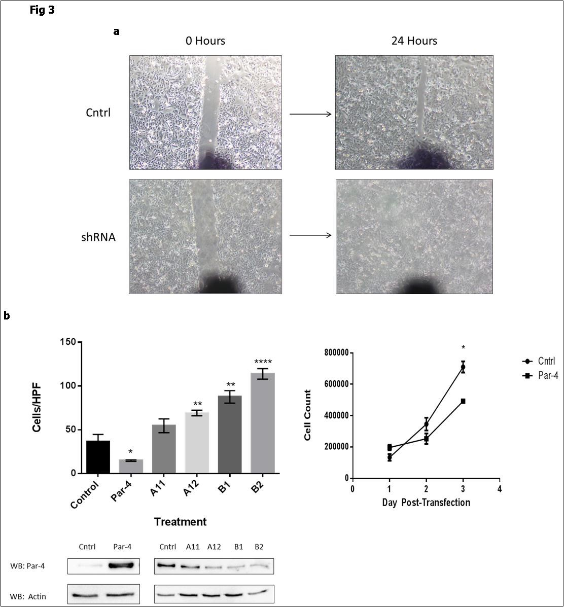Journal Of Colon And Rectal Cancer-Colon cancer