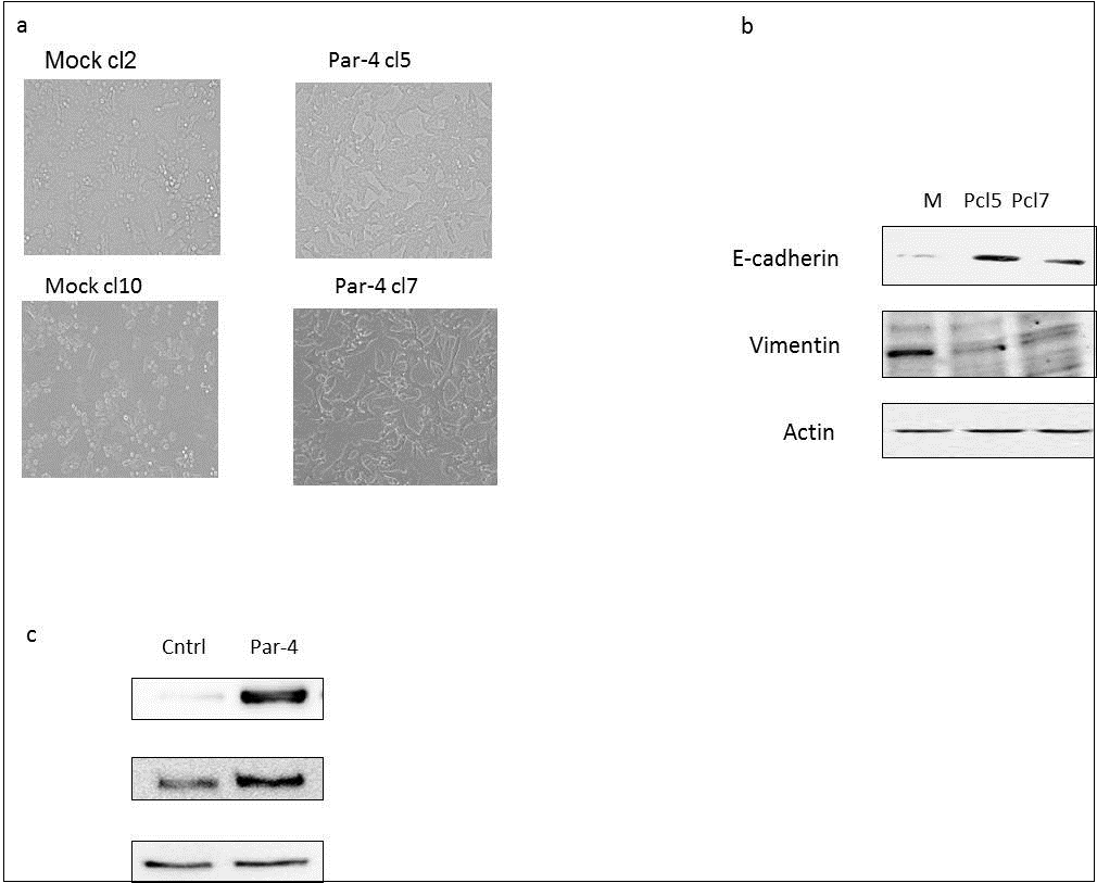 Journal Of Colon And Rectal Cancer-Colon cancer