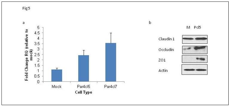 Journal Of Colon And Rectal Cancer-Colon cancer