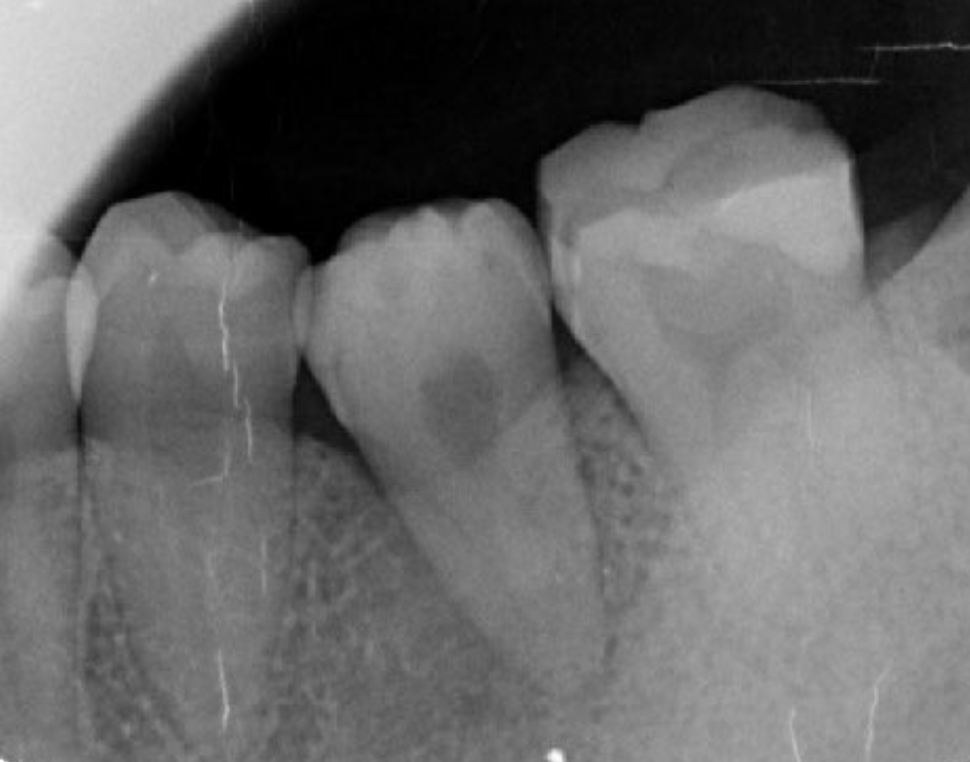 Journal of Dentistry And Oral Implants-Auto transplantation