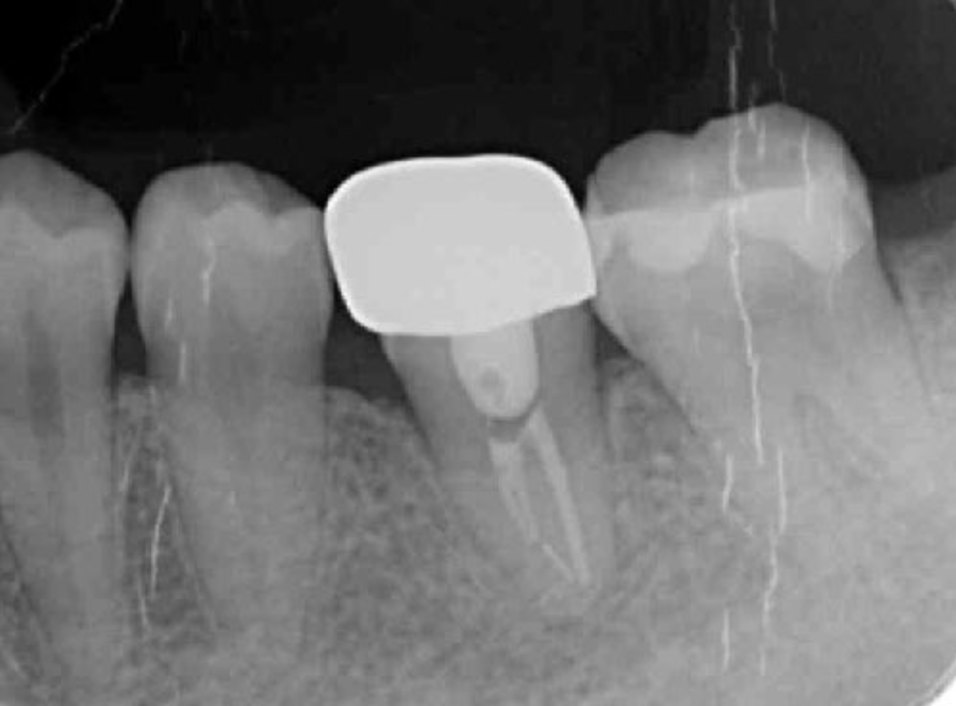 Journal of Dentistry And Oral Implants-Auto transplantation
