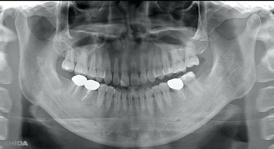 Journal of Dentistry And Oral Implants-Auto transplantation