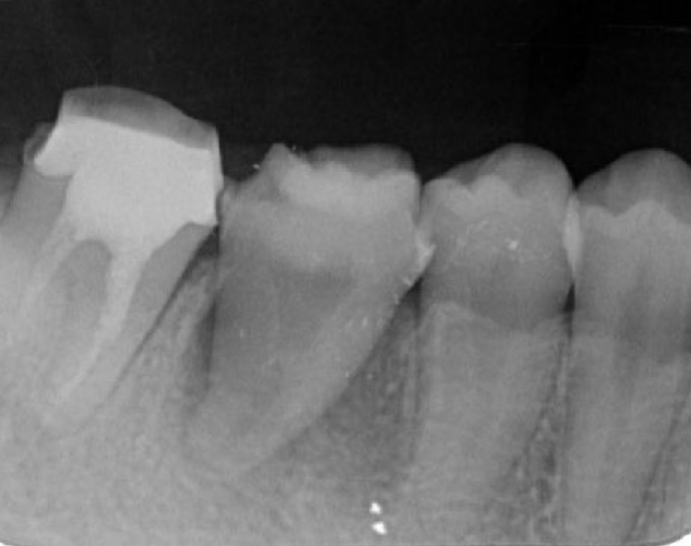 Journal of Dentistry And Oral Implants-Auto transplantation