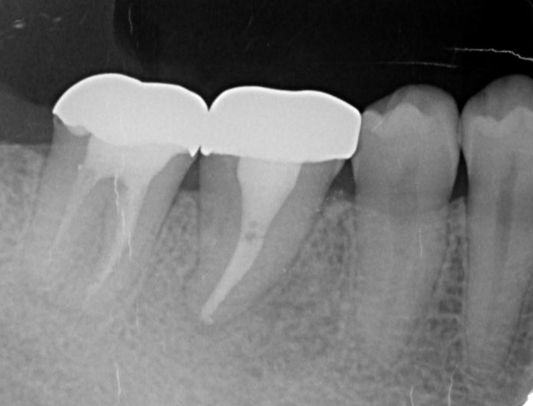 Journal of Dentistry And Oral Implants-Auto transplantation