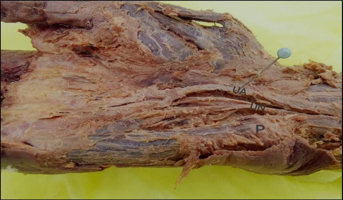 International Journal of Human Anatomy-Ulnar nerve