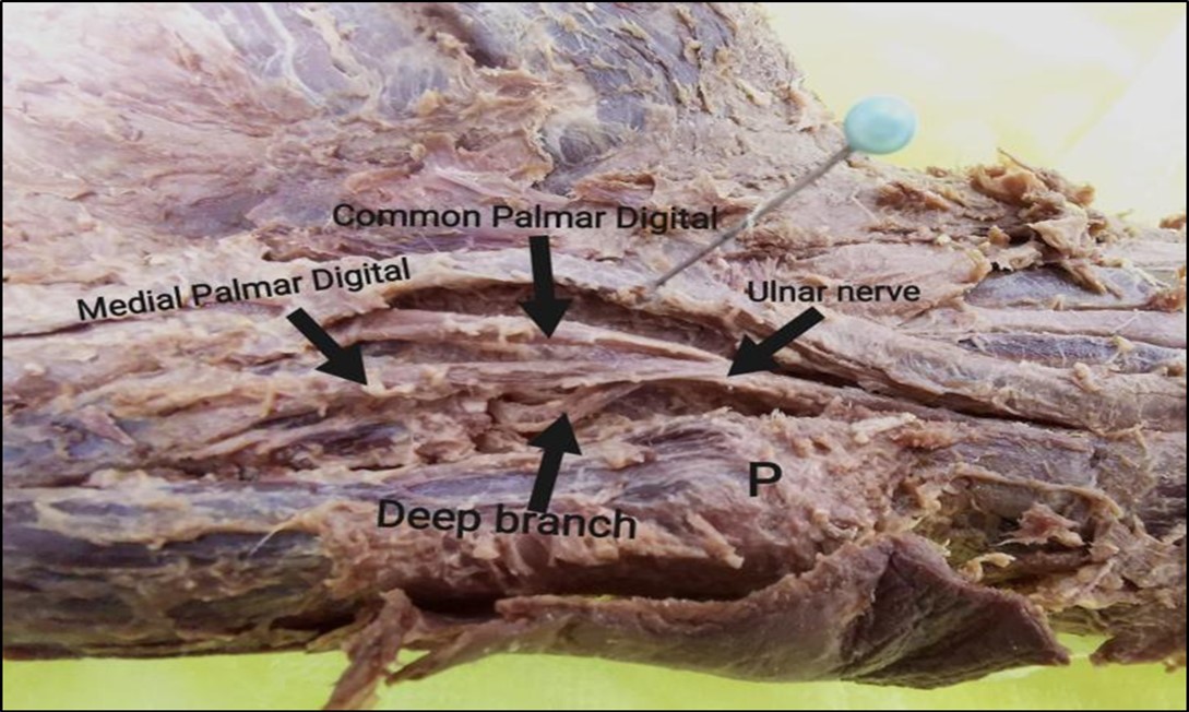 International Journal of Human Anatomy-Ulnar nerve