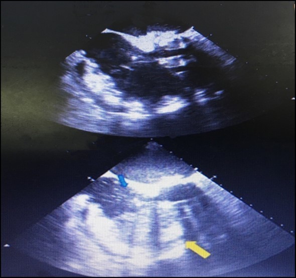 International Journal of Human Anatomy-Pericardium