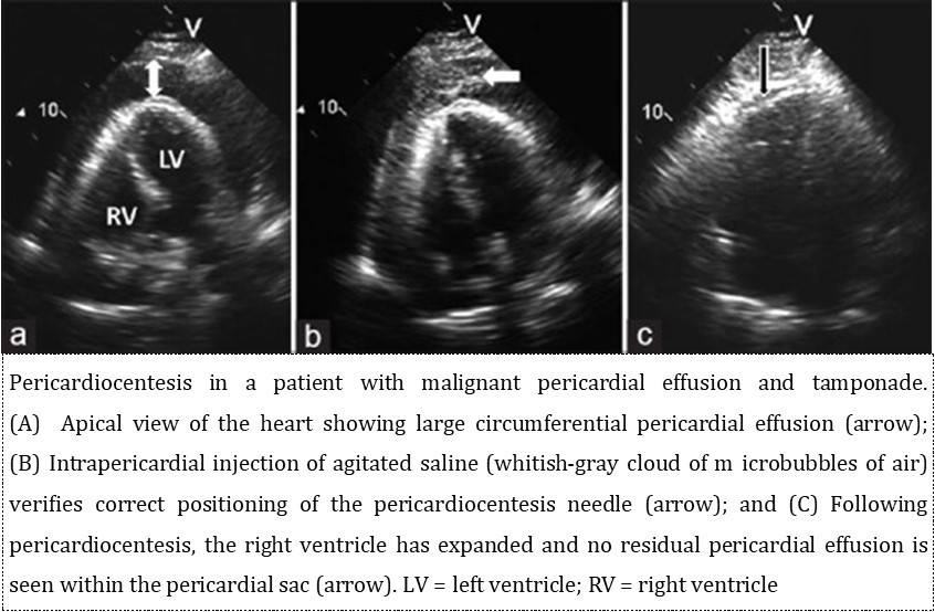 International Journal of Human Anatomy-Pericardium