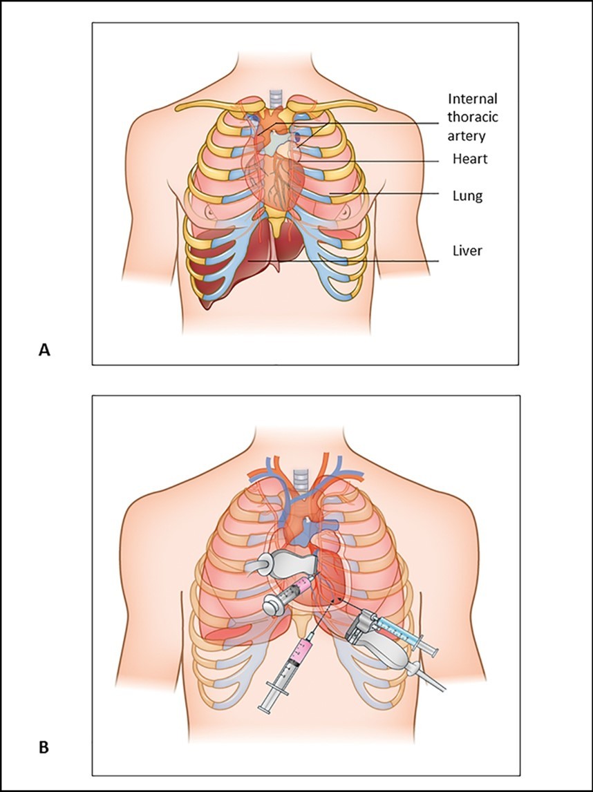 International Journal of Human Anatomy-Pericardium