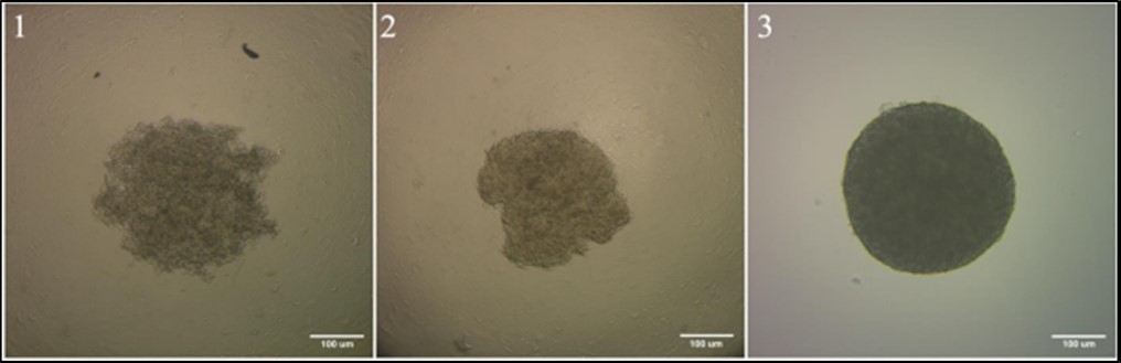 Journal of Hematalogy and Oncology Research-Spheroids