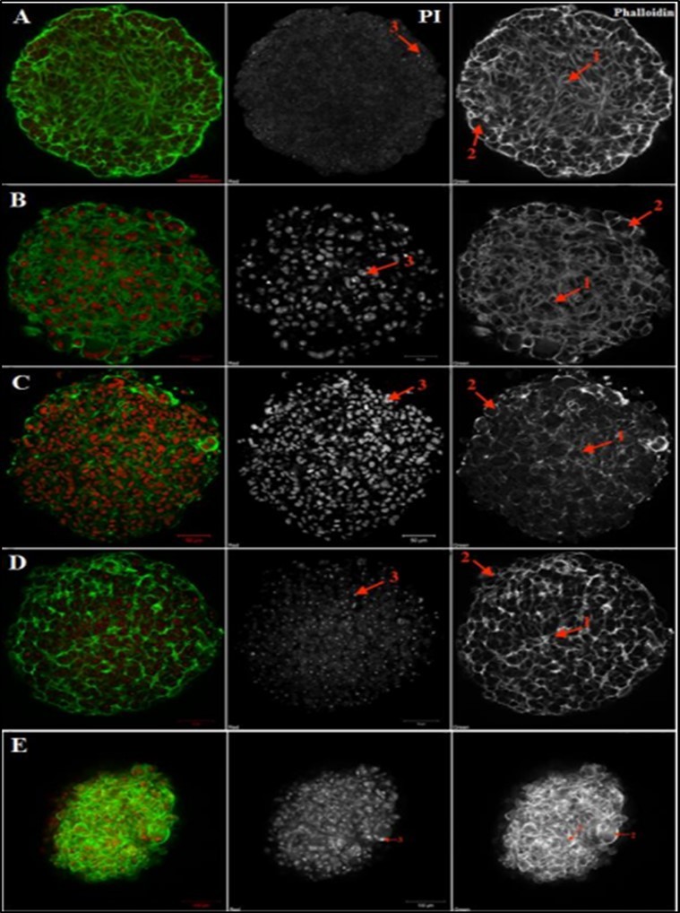 Journal of Hematalogy and Oncology Research-Spheroids
