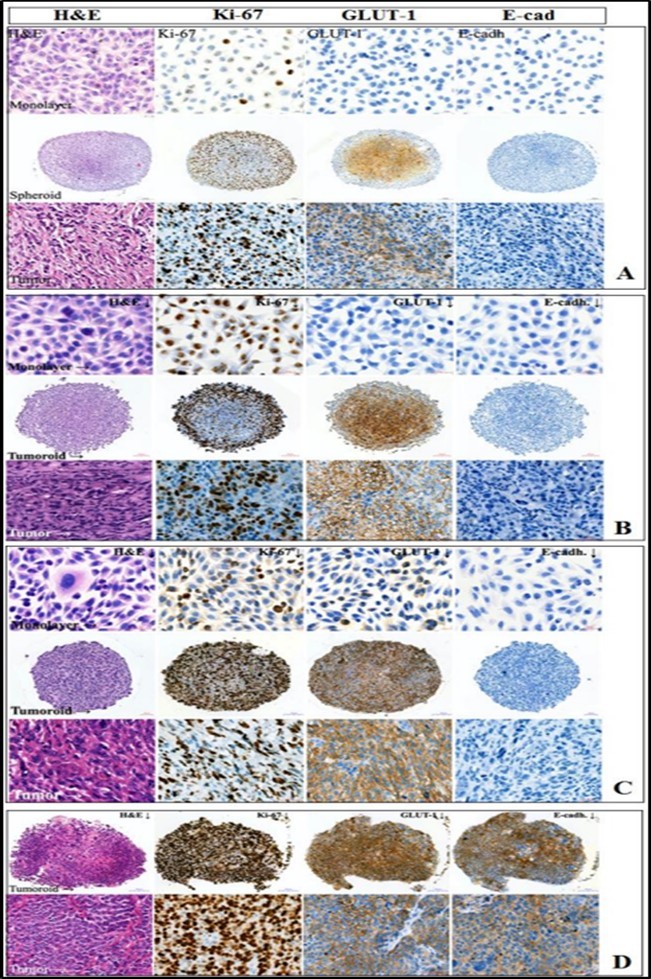 Journal of Hematalogy and Oncology Research-Spheroids
