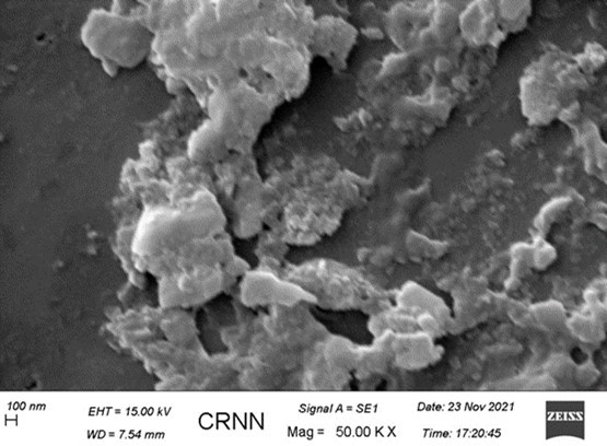 International Journal of Coronaviruses-SARS-CoV-2