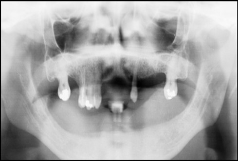 Journal of Dentistry And Oral Implants-Implants