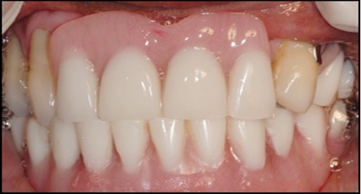 Journal of Dentistry And Oral Implants-Implants