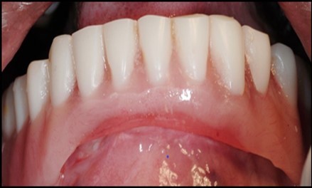 Journal of Dentistry And Oral Implants-Implants