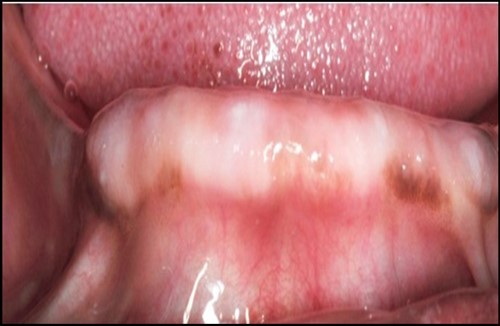 Journal of Dentistry And Oral Implants-Implants