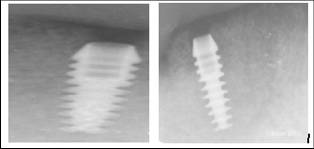 Journal of Dentistry And Oral Implants-Implants