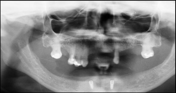 Journal of Dentistry And Oral Implants-Implants