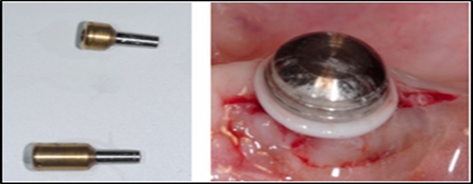 Journal of Dentistry And Oral Implants-Implants
