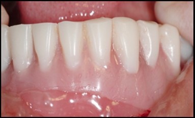 Journal of Dentistry And Oral Implants-Implants