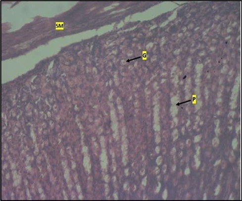 Journal of Public Health International-Large intestine