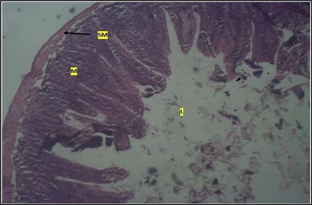 Journal of Public Health International-Large intestine