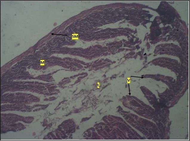 Journal of Public Health International-Large intestine
